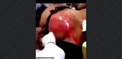 ​一男子连续喝25瓶红牛，结局太渗人！心跳已按不住