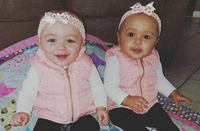 混血双胞胎：长相一样，但肤色迥异，一黑一白很是罕见