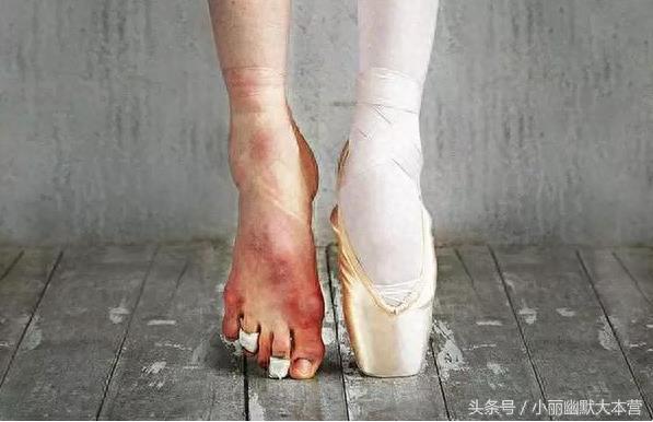 直击芭蕾舞演员幕后的脚，背后的心酸有谁能知道