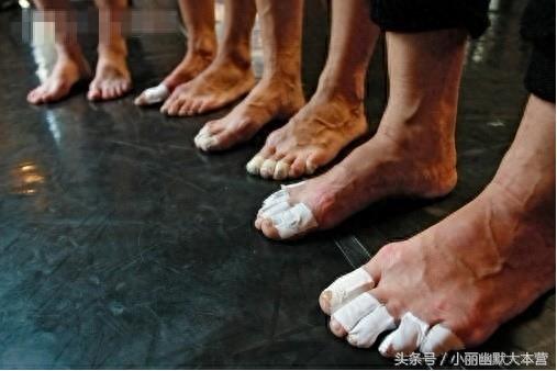 直击芭蕾舞演员幕后的脚，背后的心酸有谁能知道