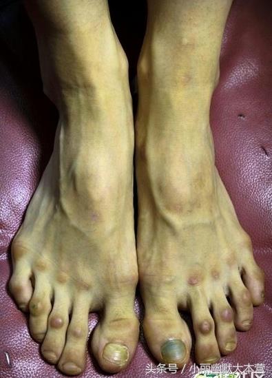 直击芭蕾舞演员幕后的脚，背后的心酸有谁能知道