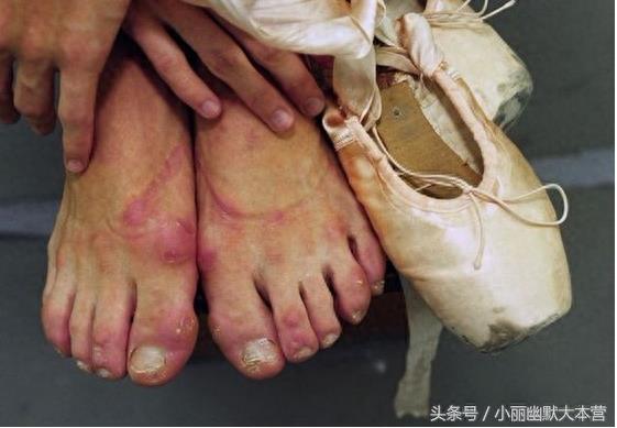 直击芭蕾舞演员幕后的脚，背后的心酸有谁能知道