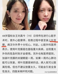 ​叶克膜-人工肺-肺移植-重症新冠肺炎患者新生路