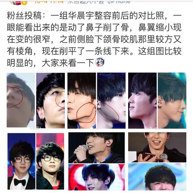 华晨宇到底整没整容?疑似华晨宇回应承认整容传闻?