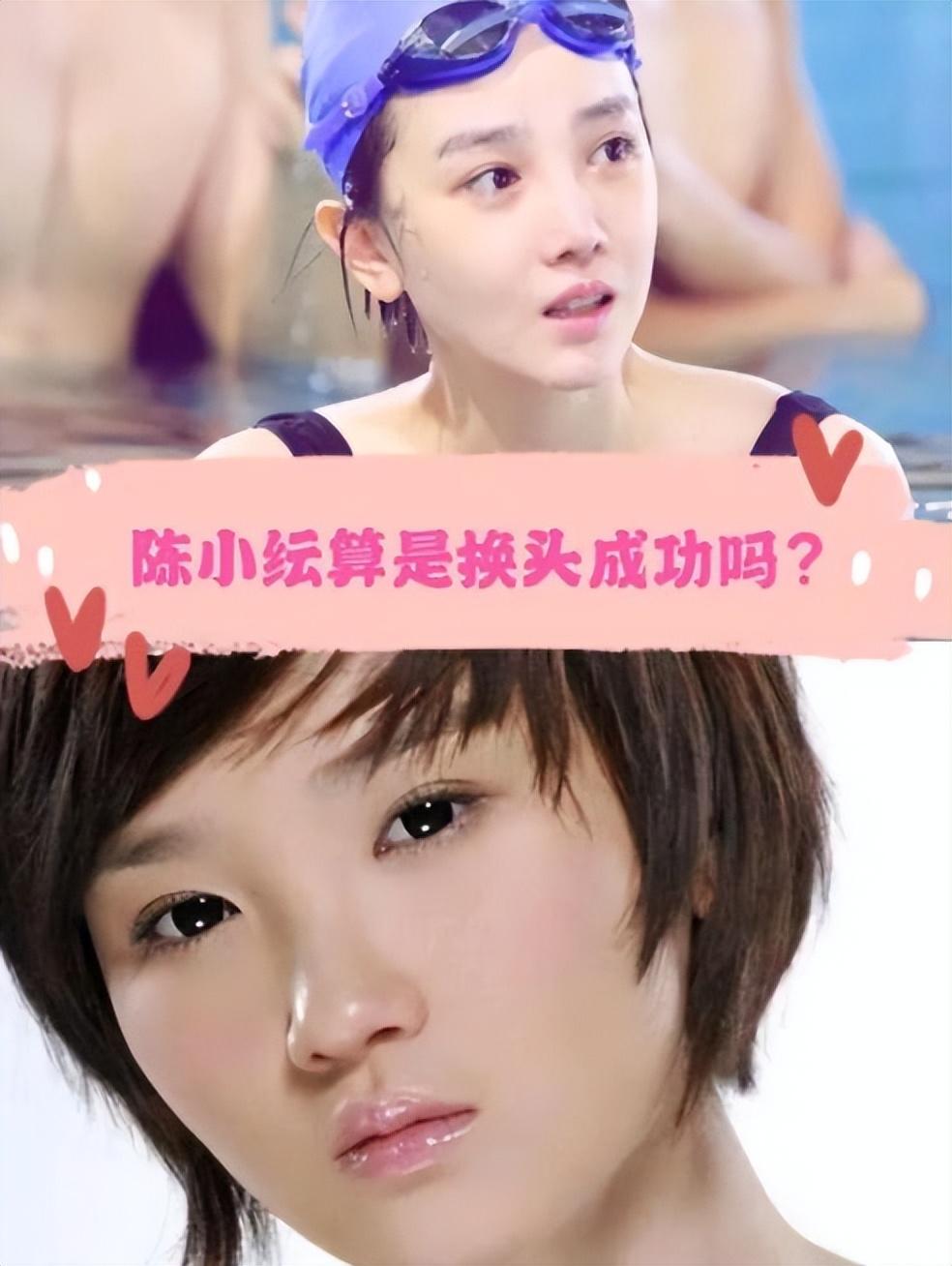 公开承认整容的明星 ，柳岩表示打过瘦脸针，最后一位让人意想不到