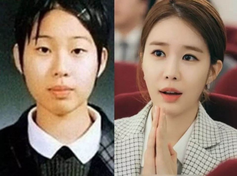 具荷拉整容威胁演艺事业(具荷拉大方承认整容问题)