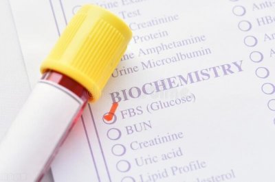 ​什么是空腹？空腹应该注意些什么？