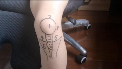 ​不同位置的膝盖疼，预示着不同的疾病！骨科医师的一张图，教你秒懂