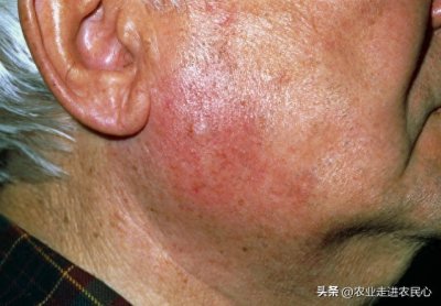 ​人要脸树要皮，但是你也没必要打自己的脸打肿充胖子吧？奇葩