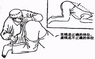 ​考上公务员后必过的一关——＂爆菊花＂